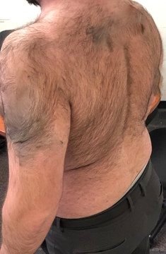 Fellow One Research Free Body Type Shape Quiz Calculator, The Four Body Types Research Participant 589, Body Type Three (BT3) Male