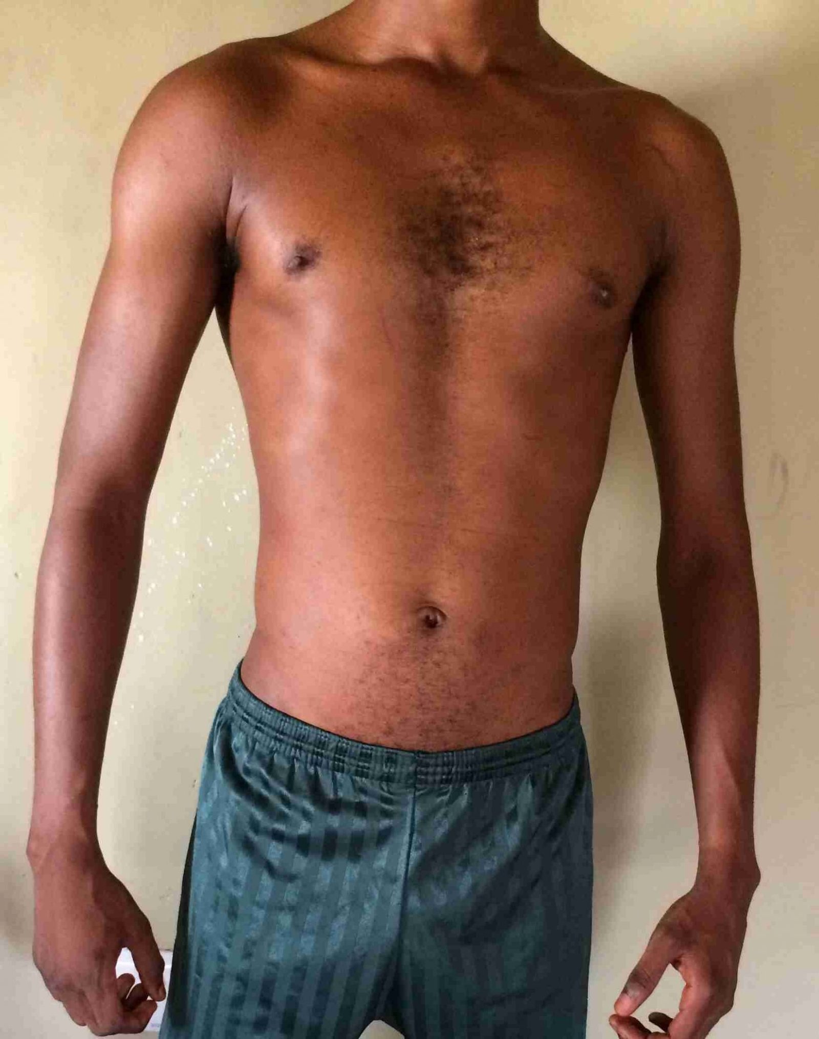 Body Type Test (Quiz) Results 714 Body Type One (BT1) Male (Man