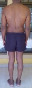 Body Type Quiz/Test (Men/Male/Man) Results 1115, Fellow One Research - The Four Body Types, Body Type One (BT1)