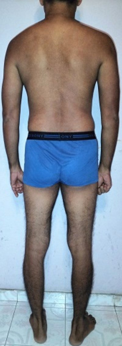 Body Type Quiz - The Four Body Types