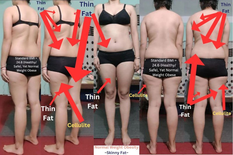 RP 1070 Normal Weight Obesity, Thin Fat and Cellulite Skinny Fat - FAQ - Body Type Science Theory
